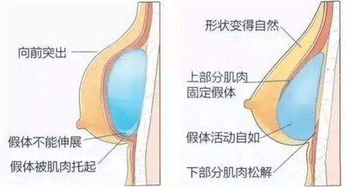 韩国整形梗有哪些之沟通障碍，浪漫江南多语客服