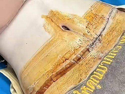 韩国整形医院排名综合考量,浪漫江南为您打造专属医美之旅