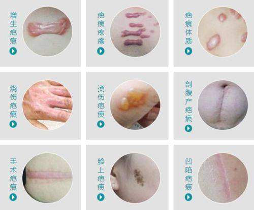 韩国整形医院有中文翻译吗?浪漫江南推动社区交流与分享