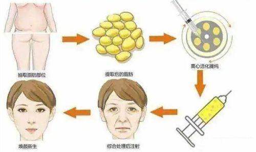 揭秘韩国整形梗！浪漫江南一站式直约平台，3000+韩医美机构，多服务多保障