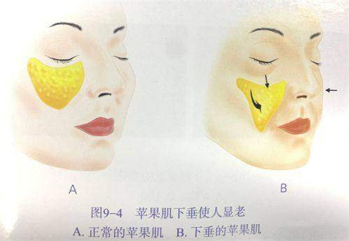 韩国整形网站模拟成效缺失,浪漫江南AI预览助力决策