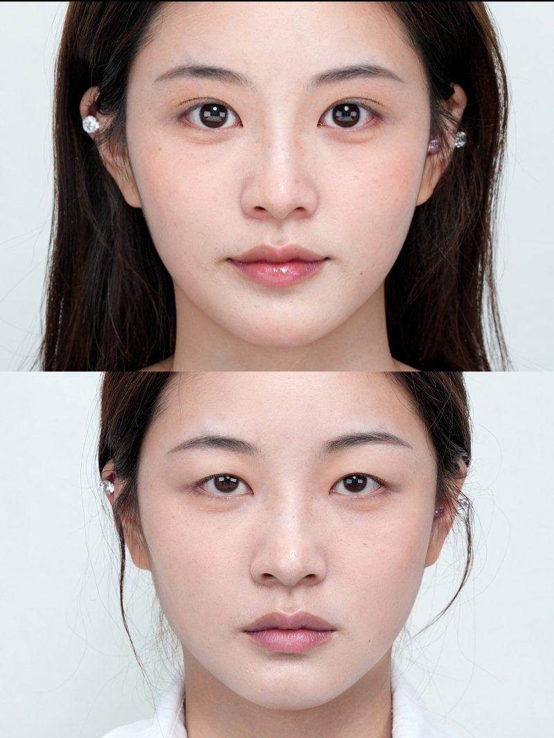 韩国整形医院排名中的隆胸专科强院,浪漫江南提供全方面信息