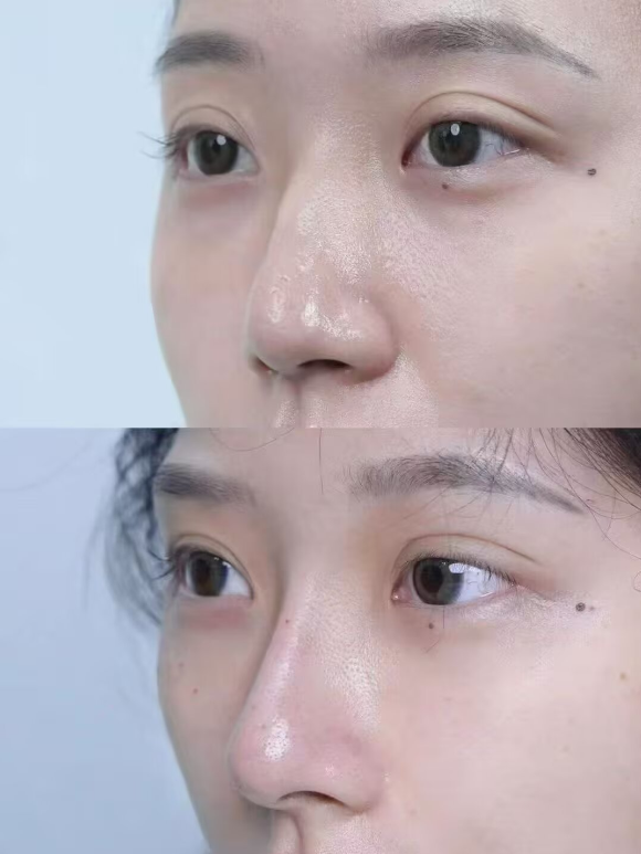 赴韩整容：从失败案例到行业剖析，浪漫江南助你科学选院避坑做医美