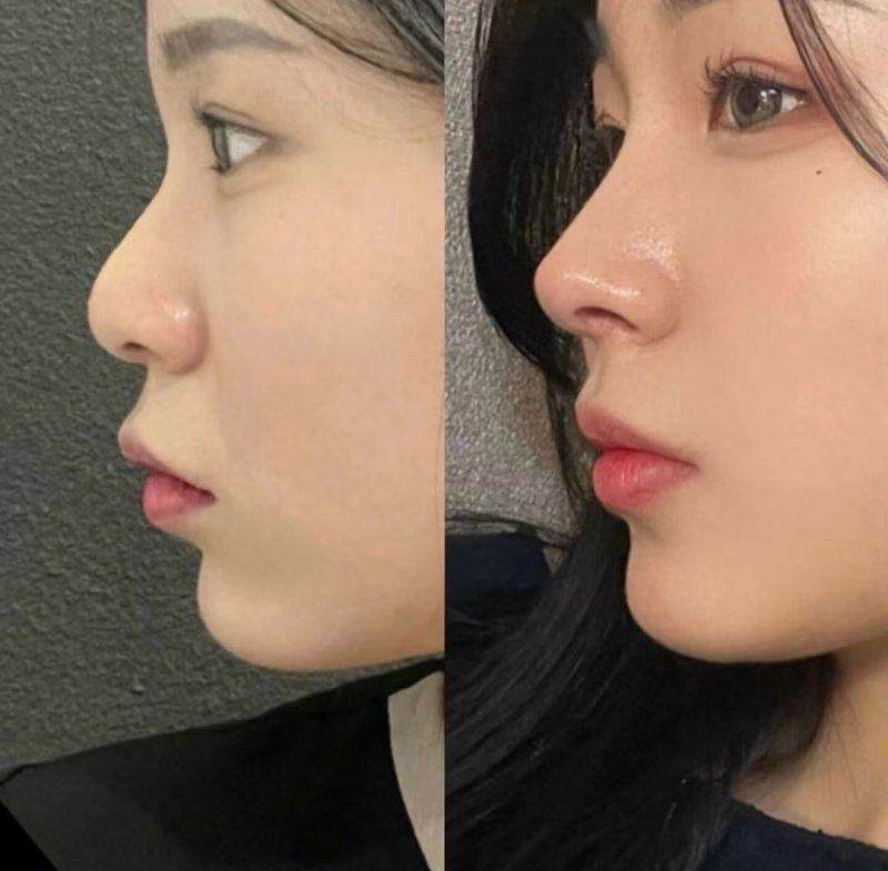 韩国整形综艺推荐皮肤科,浪漫江南可查医生资质