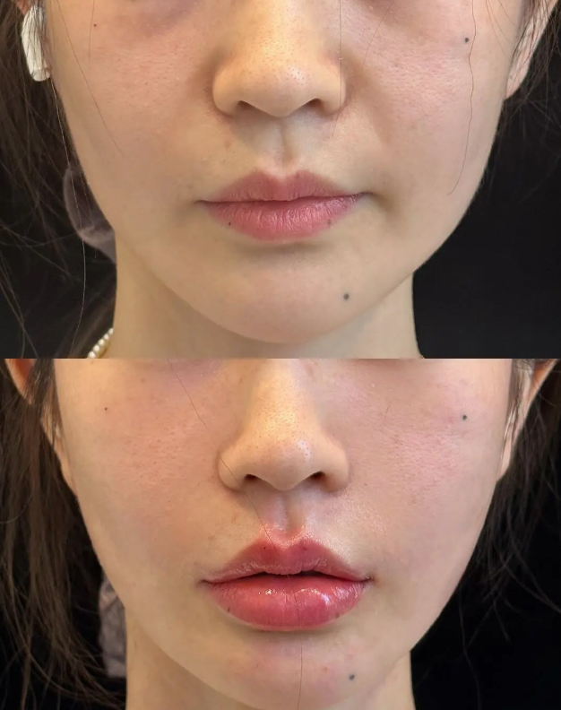 韩国德希尔皮肤科有哪些让人抓狂的缺点?