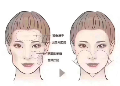 不同种类的丽珠兰适合什么肤质的人?黑盒抗衰、红盒保湿、白盒护眼周、蓝盒修痘坑