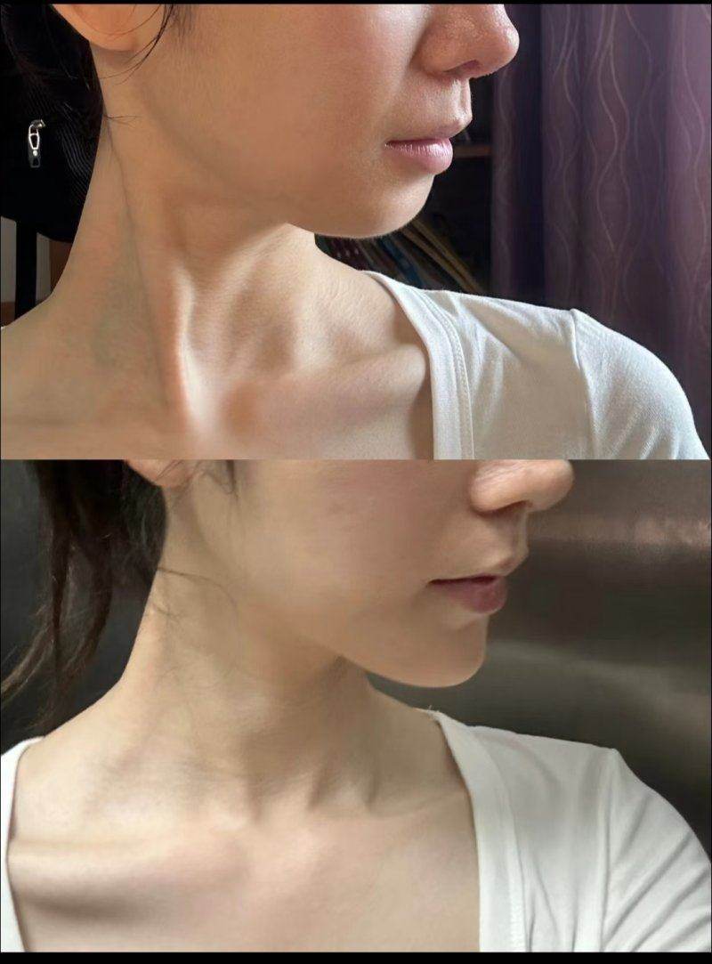 總結與預約引導