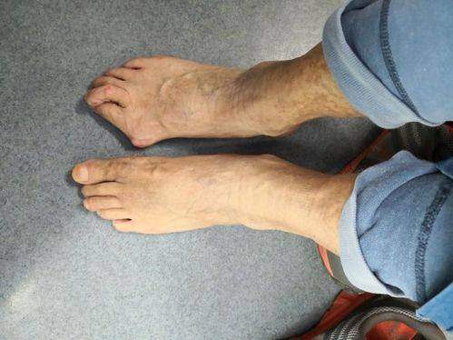 金泰拉抗衰中 心為何是韓國本地人去的貴婦皮膚科有哪些中的首選