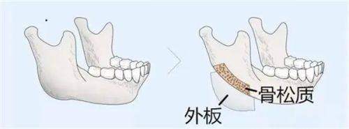 韓國皮肤科哪家有onda?清潭美乐皮肤科性价比之王解析