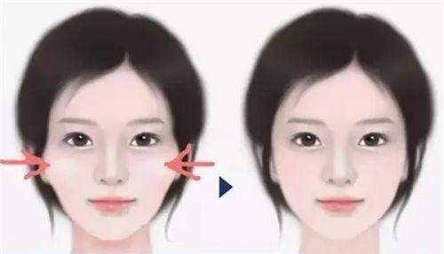 韓國做re2o哪家皮肤科好之術後護理與恢復期管理