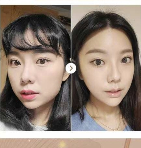 韓國本地人去的貴婦皮膚科有哪些?推薦金泰拉等5家高端抗衰名院,上浪漫江南小程序預約