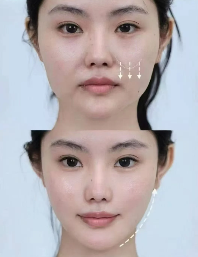 Elev皮肤科憑藉什麼技術成為韓國本地人去的貴婦皮膚科有哪些中的技術派