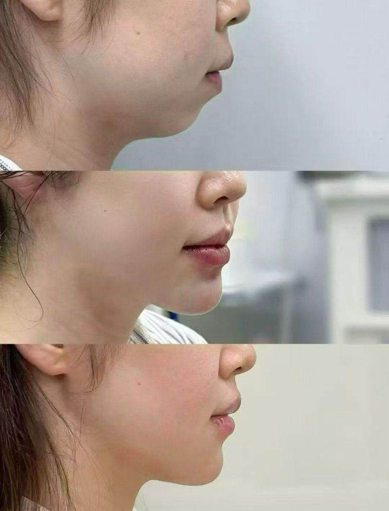 韓國做re2o哪家皮肤科好?查設備與醫生資質,上浪漫江南小程序預約更安心