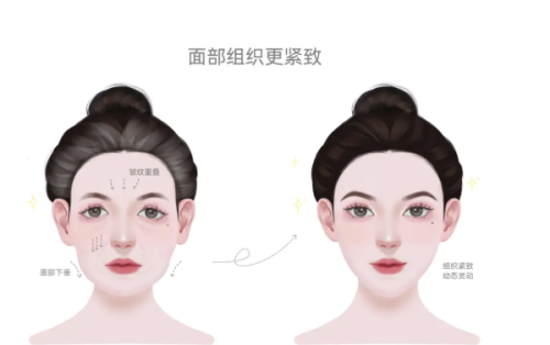 韩国医美项目推荐之至佳时机与预约策略