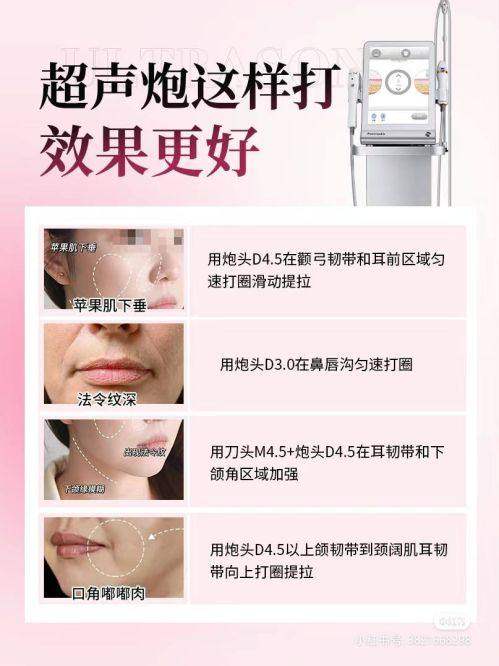 韩国医美签证C-3-9与C-3-3类型对比怎么选