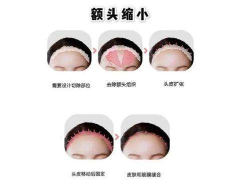 如何通過浪漫江南小程序預約韓國醫美機構