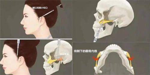 韩国鹿美人皮肤科热门项目价格明细参考