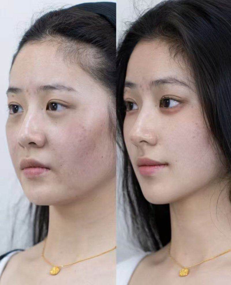 韓國醫美退稅適用項目範圍與常見價格區間