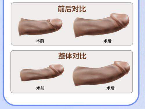 韩国皮肤科更厉害的三个医院的预约避坑指南
