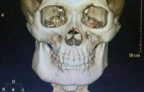 韓國皮膚科學研究院謝坤医生的口碑與真實反饋如何?