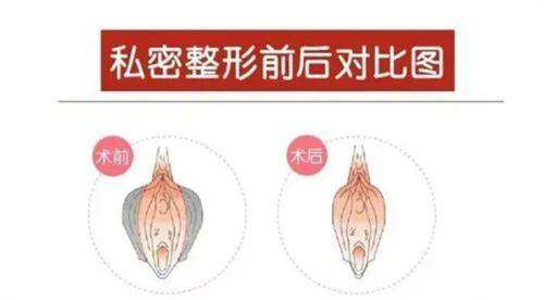 2026韩国皮肤科医院排名中Pangpang的特色提升技术解析