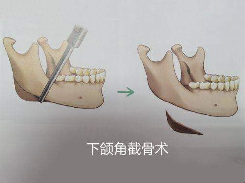 2026韓國皮膚科推薦中的價格差異與避坑指南