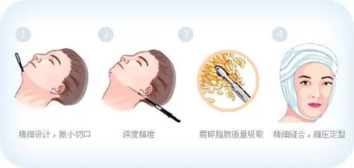 韩国皮肤科排名中金泰拉抗衰中 心的性价比体现在哪里