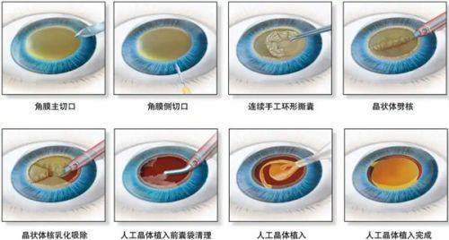 韓國皮膚科攻略:Dr. Evers與濟州头等美人怎么选?