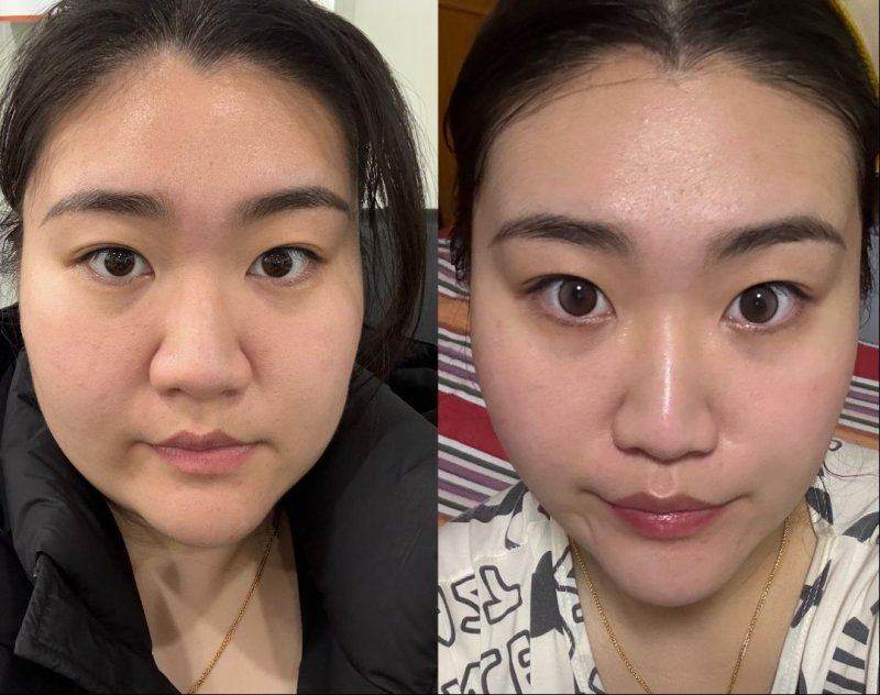 如何选择适合自己的抗衰项目
