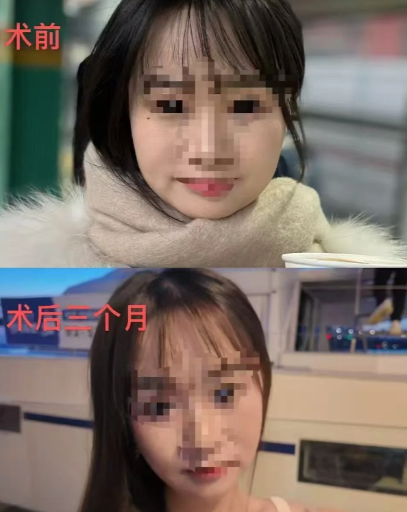 選擇韓國皮膚科學研究院謝坤医生需要注意哪些風險與事項?