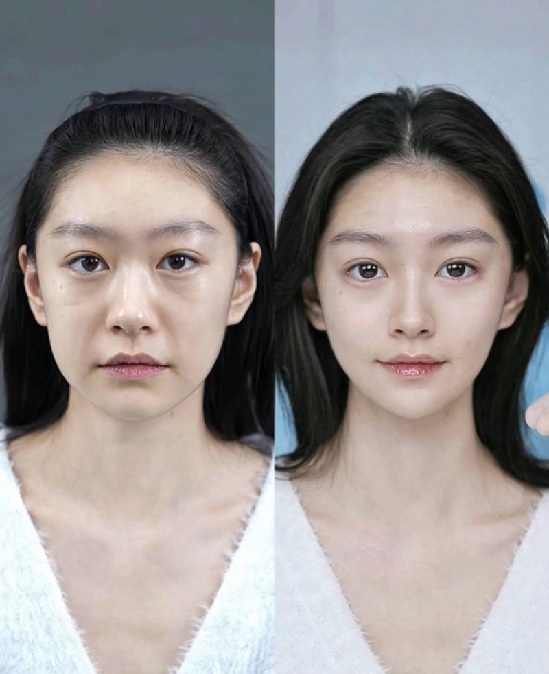 韩国Luho汝好整形外科:高难度眼修复的正规专科