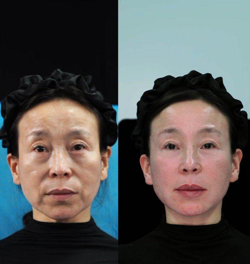 想去濟州島美麗皮膚科做電音波嗎