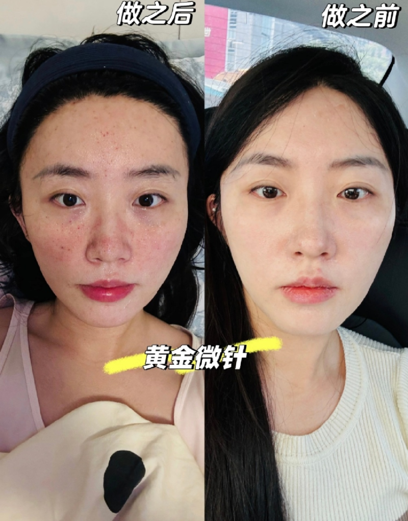 数据与现实:真实反馈与避坑指南