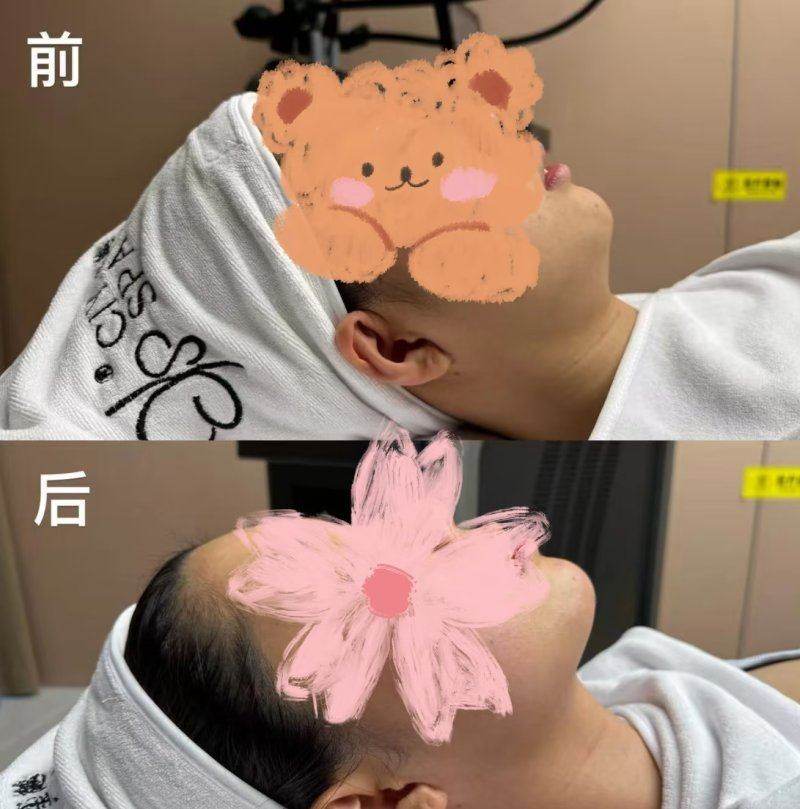 為什麼選擇Meifill美妼進行皮膚管理