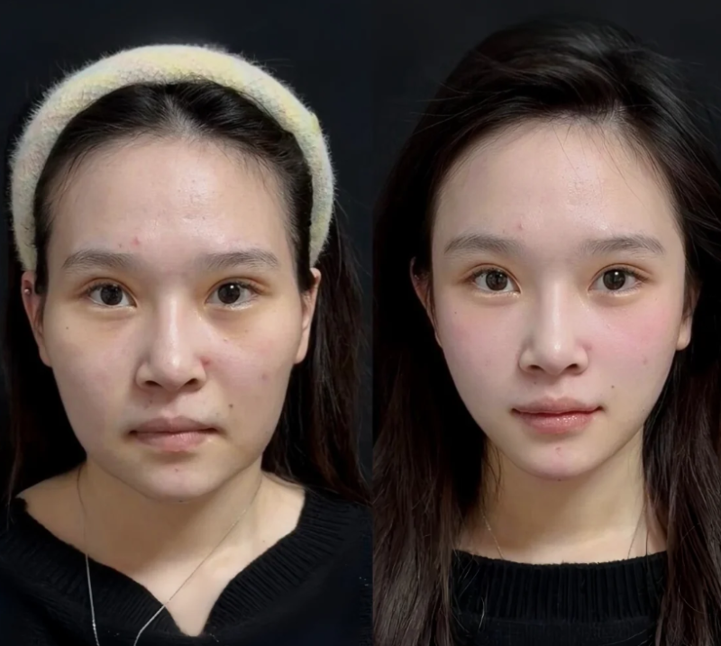韓國Meifill美妼皮膚科怎麼預約掛號？2026年透過「浪漫江南」小程式輕鬆鎖定優質醫美資源
