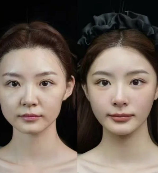 釜山醫美推薦清單|Jryn敏感肌修護、VelyB無恢復期煥膚,透過「浪漫江南」小程式輕鬆預約